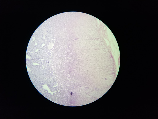 Adrenal Slides - Adrenal 012 100X